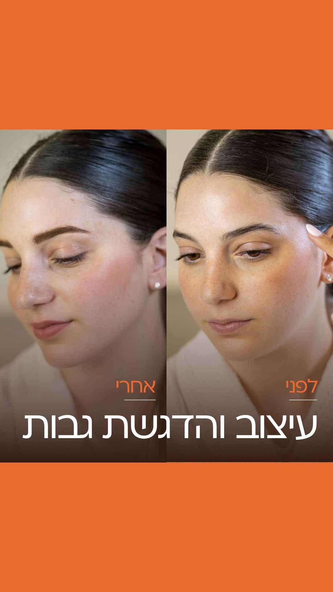 Copy Of טיפולים הזרקות (1080 X 1920 Px)